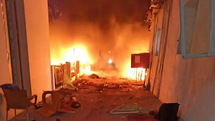 İsrail acımadı! Hastaneyi göz göre göre vurdu! Çok sayıda ölü var!