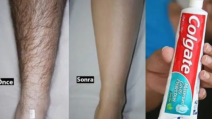 İstenmeyen tüylerin doğal düşmanı! Limon + şekerin faydaları sizi şok edecek…