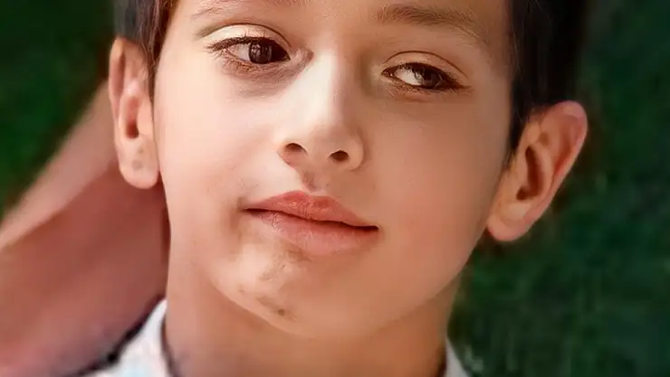 Kazada yaralanan 13 yaşındaki çocuktan acı haber