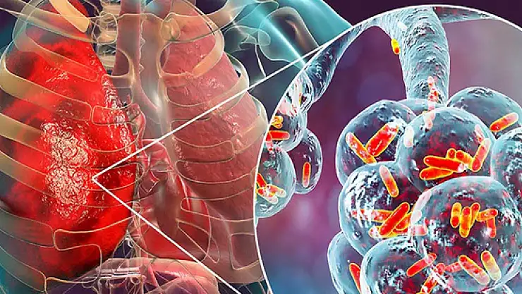 Klimanın yol açtığı 'lejyoner hastalığı'na karşı uzman isim uyardı!