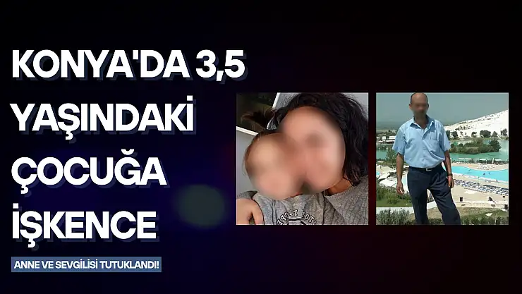 Konya'da 3,5 yaşındaki çocuğa işkence: Vücudunda sigara söndürüp darp ettiler, anne ve sevgilisi tutuklandı!