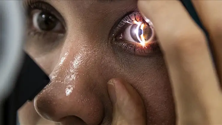 Konya'da uzman doktordan uyarı! Göz muayenesi beyin hastalıklarını ele veriyor