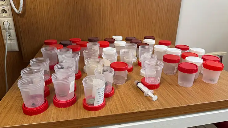 Küçük çocuğun yemek borusundaki para çıkarıldı