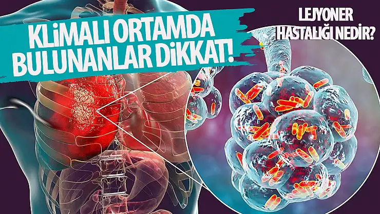 Lejyoner hastalığı (Klima Zatürresi): Nedir, belirtileri ve bulaşma yolları