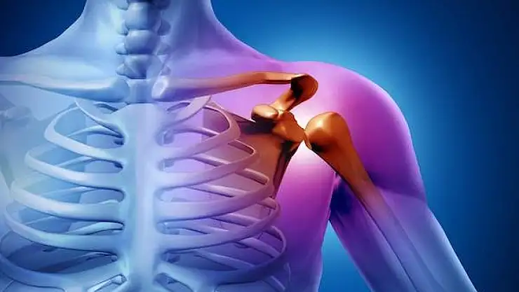Omuz Sıkışması Sendromu Nedir?