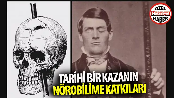 Phineas Gage: Tarihi Bir Kazanın Nörobilime Katkıları