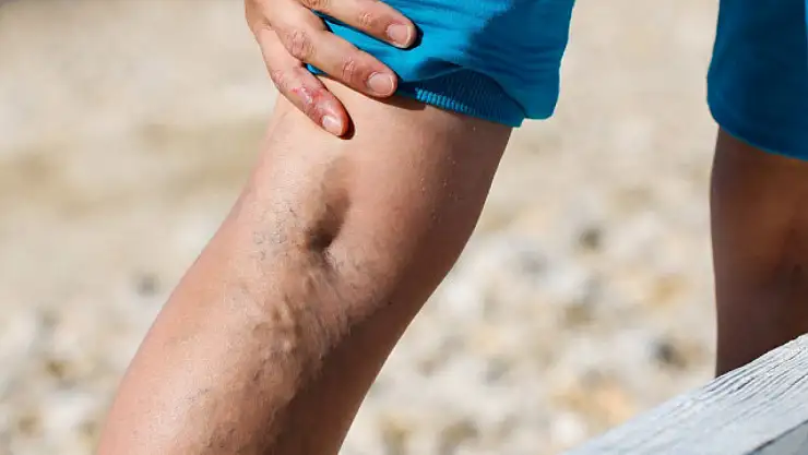 Sıcak hava varislerin artmasına sebep olabilir