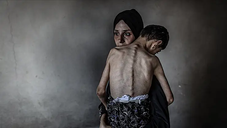 Son 24 saatte 8 kişi daha açlıktan hayatını kaybetti