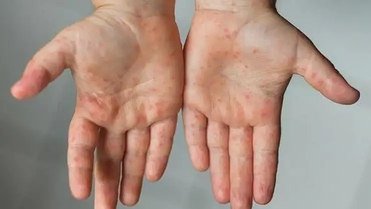 TTB'den uyarı: hepimiz etkileneceğiz