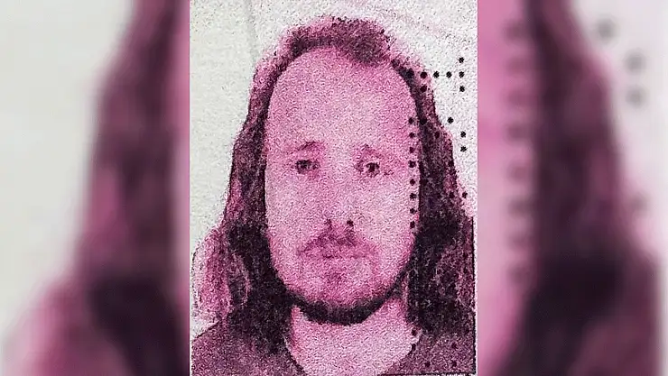 Türkiye'de saç ektirip dişlerini yaptıran turist, operasyonların ardından öldü