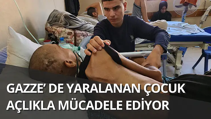 Yaralı çocuk yaşam mücadelesi veriyor: Yetersiz beslenme sonucu 20 kilo kaybetti
