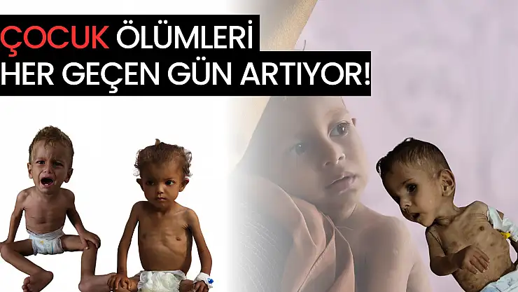 Yetersiz beslenme nedeniyle çocuk ölümleri artıyor!