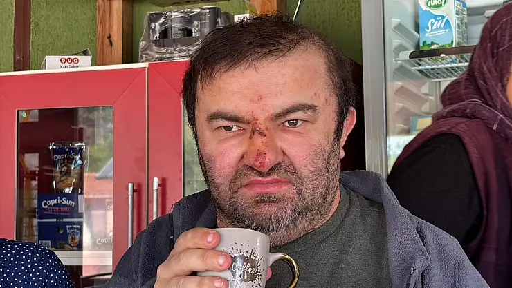 Yüzde 90 engelli vatandaşı acımasızca darp ettiler