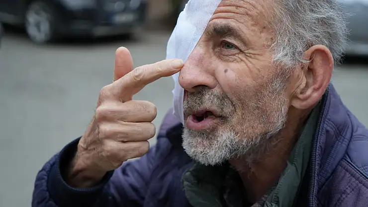 Yüzü eriyen adam doktorlarda çare arıyor