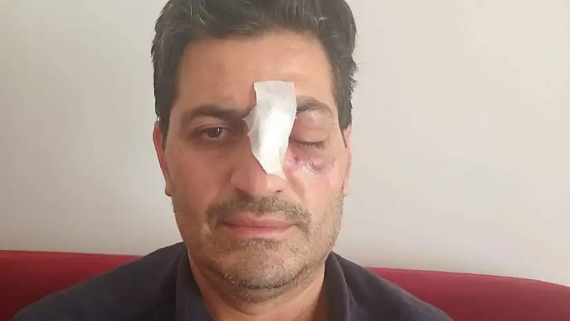 Cami avlusundaki uyarı kavgaya dönüştü: Müezzinin burnu kırıldı