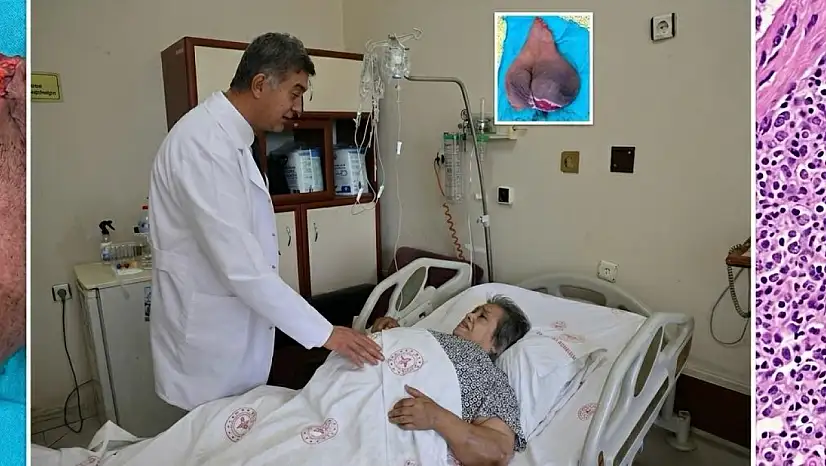 Çekyat üstünde geçen 15 yıl sona erdi! Dev kitle ameliyatla temizlendi