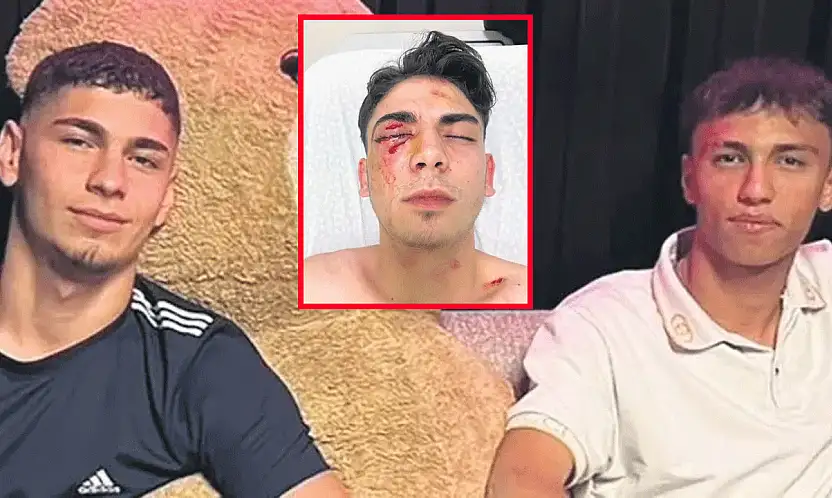 Konya'da 18 yaşındaki genci muştayla kör etmişlerdi! İstenilen ceza belli oldu