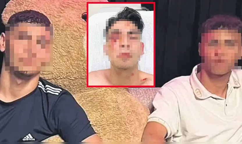 Konya'da 18 yaşındaki genci muştayla kör etmişlerdi! İstenilen ceza belli oldu