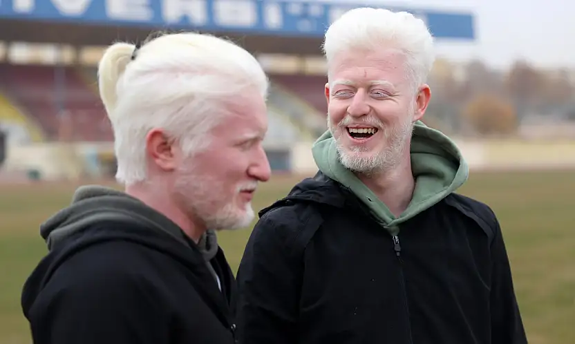 Konya'da 'dostluk' hikâyesi: Atletizm pisti buluşturdu, albinizm kenetledi