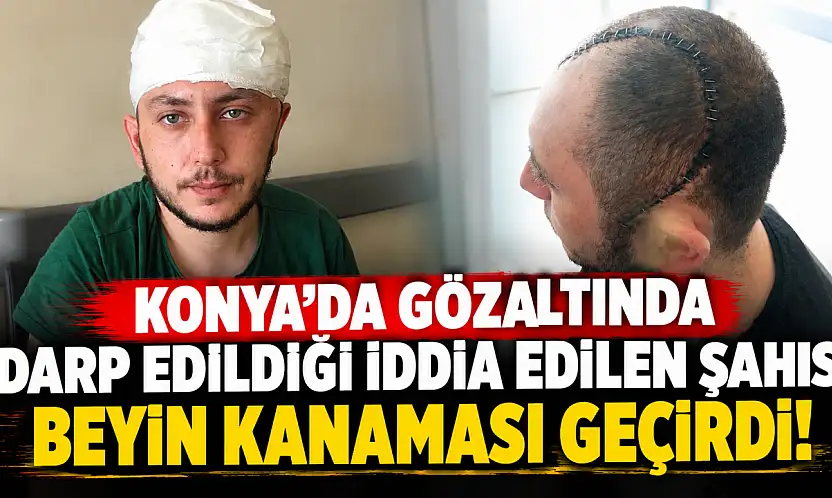 Konya'da gözaltında darp edildiği iddia edilen şahıs beyin kanaması geçirdi!