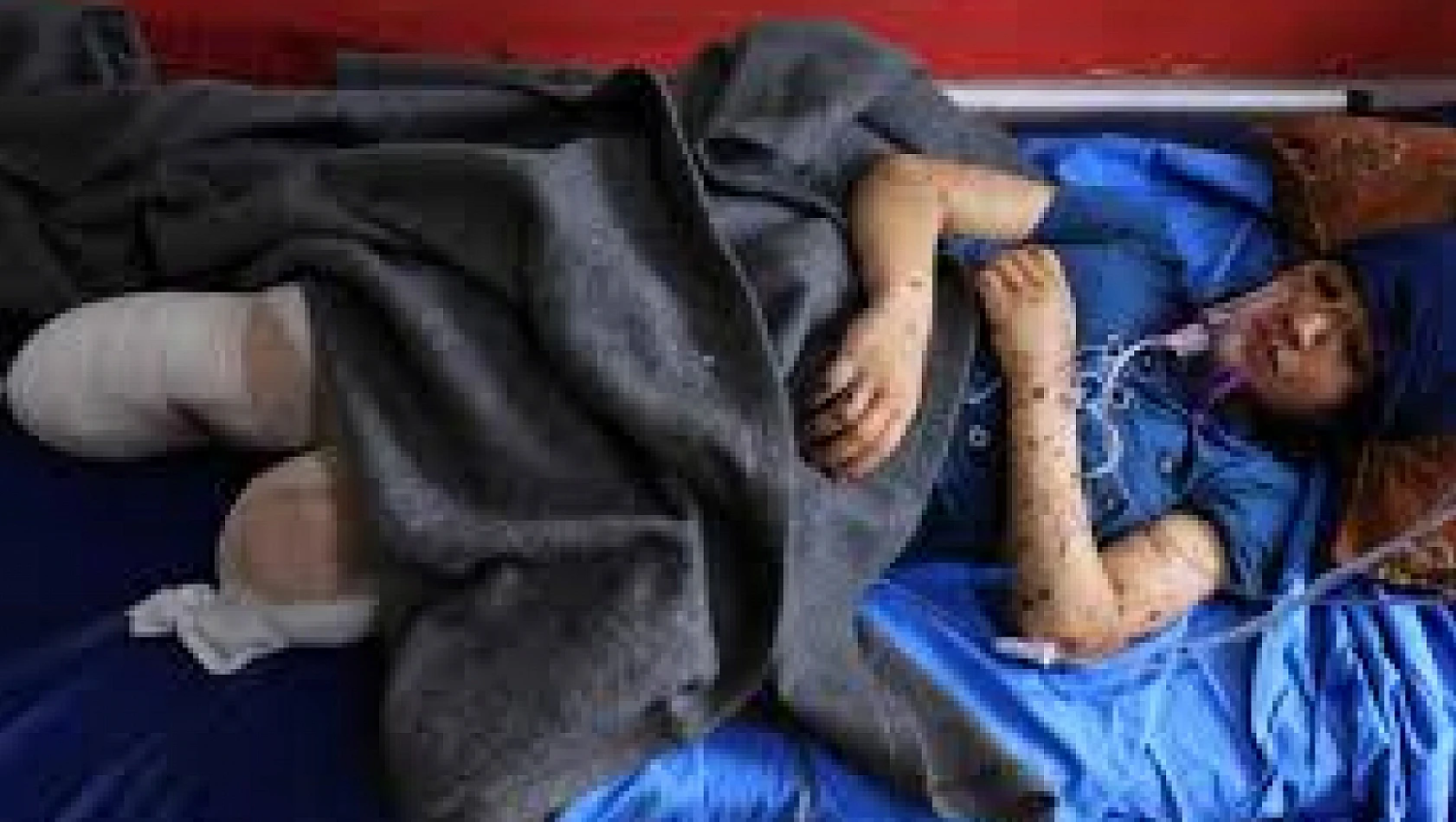 İsrailli doktor Gazze'de alıkonulanların bacaklarının 'kelepçe nedeniyle kesildiğini' ifade etti