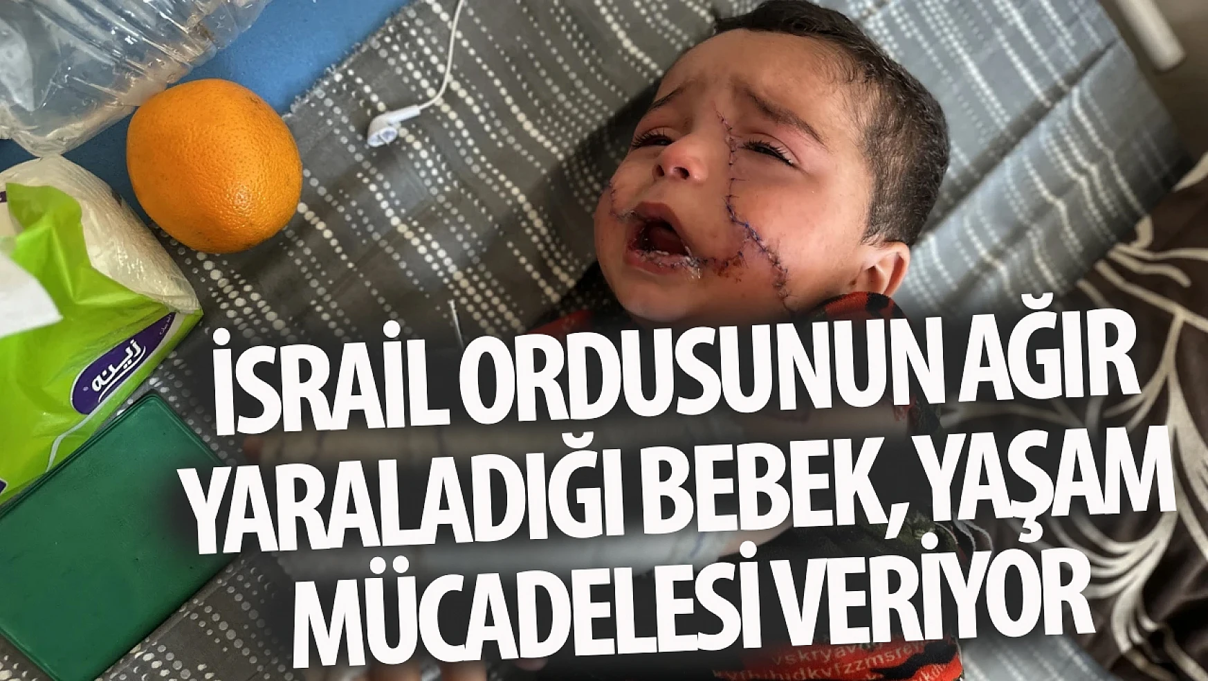 İsrail ordusunun ağır yaraladığı bebek, yaşam mücadelesi veriyor
