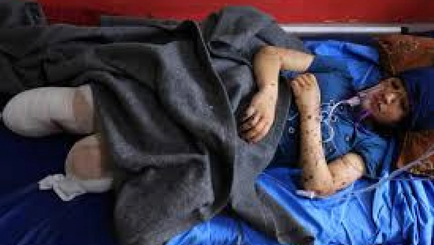 İsrailli doktor Gazze'de alıkonulanların bacaklarının 'kelepçe nedeniyle kesildiğini' ifade etti
